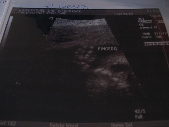 Nathan ultrasound